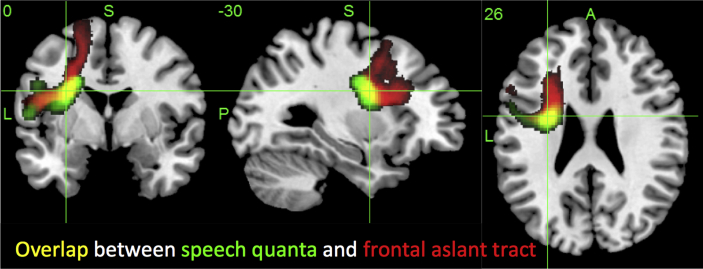 Fig. 4