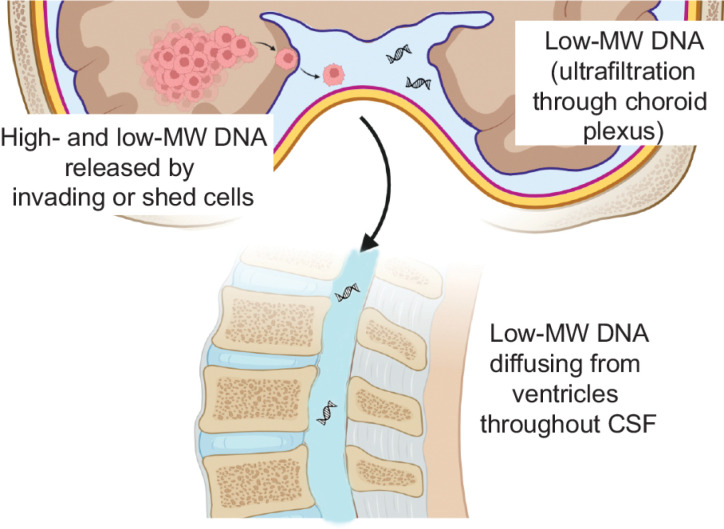 Figure 6. Features and origins of DNA found in CSF. Evidence provided in this study supports that brain tumor DNA found in CSF mostly derives from tumor cells invading liquoral spaces (or shed from tumors touching liquoral spaces), which can release both high- and low-molecular weight (MW) DNA as result of necrosis and/or apoptosis, respectively. A small amount of low-MW DNA is expected to be secreted into CSF by ultrafiltration at the physiological site of CSF formation (choroid plexus). High-MW DNA is poorly soluble and minimally diffuses throughout CSF. Low-MW DNA is soluble, but the slow dynamic of CSF circulation can prevent its diffusion from the site of cell invasion to the distant point of CSF collection (lumbar puncture).