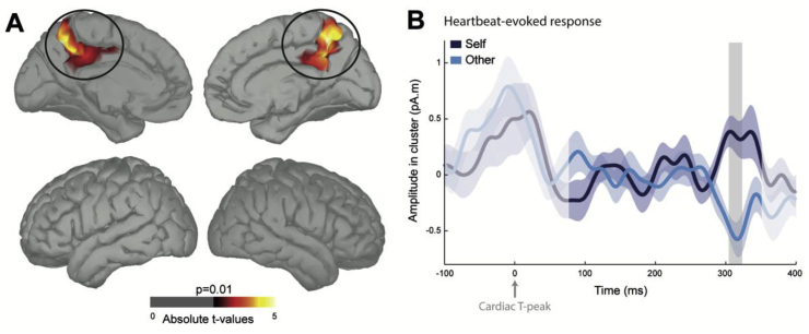 Fig. 3