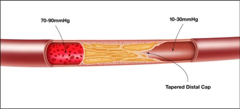 Fig. (9)