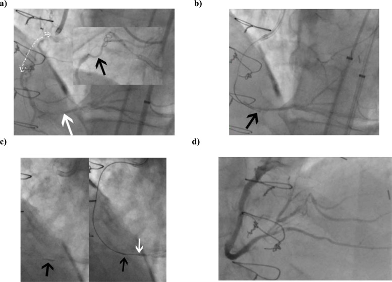 Fig. (15)