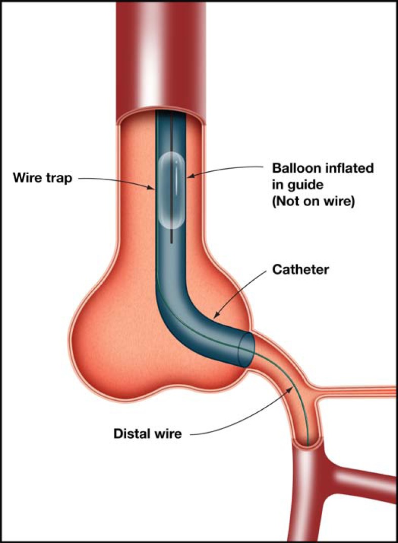 Fig. (17)