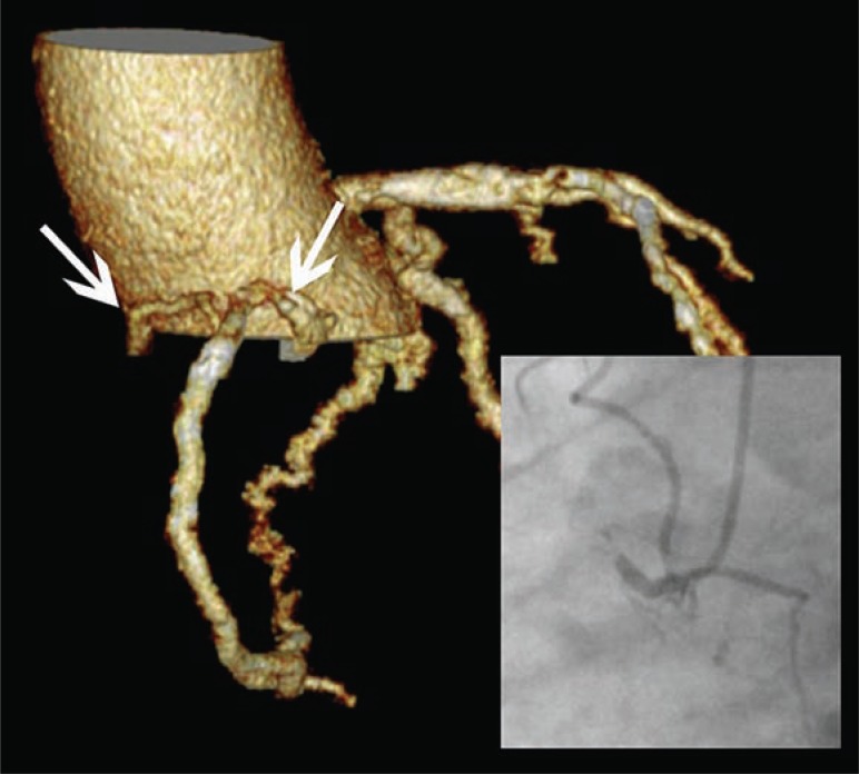 Fig. (1)