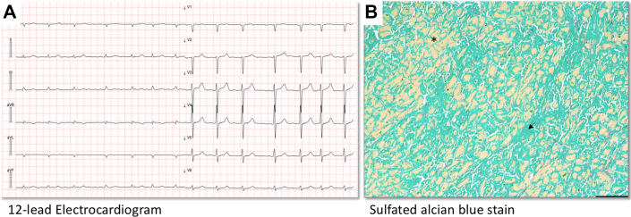 Figure 4