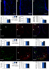 Figures 4A, 4B, and 4C comprise microscopic images and three bar graphs with standard errors of mean. Graph A plots cell number and Graphs B and C plot fiber density (arbitrary units) for the Veh and 5 and 50 micrograms per kilogram per day DEHP exposure groups. Figure 4D comprises three microscopic images for GFP, AR, and both merged, as well as three bar graphs with standard errors of mean plotting cell number, percentage of GFP-AR plus cells, and percentage of GFP-ER alpha plus cells for the Veh and 5 and 50 micrograms per kilogram per day DEHP exposure groups. Figure 4C comprises three microscopic images for GFP, AR, and both merged, as well as three bar graphs with standard errors of mean plotting cell number, percentage of GFP-AR plus cells, and percentage of GFP-ER alpha plus cells for the Veh and 5 and 50 micrograms per kilogram per day DEHP exposure groups.