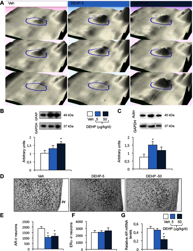 Figure 6A comprises three 3D images for Veh, DEHP-F, and DEHP-50. Figure 6B comprises two Western blots of GFAP and GAPDH as well as a bar graph with standard errors of mean plotting arbitrary units of GFAP (y-axis) for the Veh and 5 and 50 micrograms per kilogram per day DEHP exposure groups. Figure 6C comprises two Western blots of GAPDH and Actin as well as a bar graph with standard errors of mean plotting arbitrary units of Actin (y-axis) for the Veh and 5 and 50 micrograms per kilogram per day DEHP exposure groups. Figure 6D comprises three software images for Veh, DEHP-5 and DEHP-50. Figures 6E, 6F, and 6G are bar graphs with standard error plotting AR-ir neurons, ER-alpha neurons, and relative AR mRNA levels, respectively, (y-axis) for the Veh and 5 and 50 micrograms per kilogram per day DEHP exposure groups.