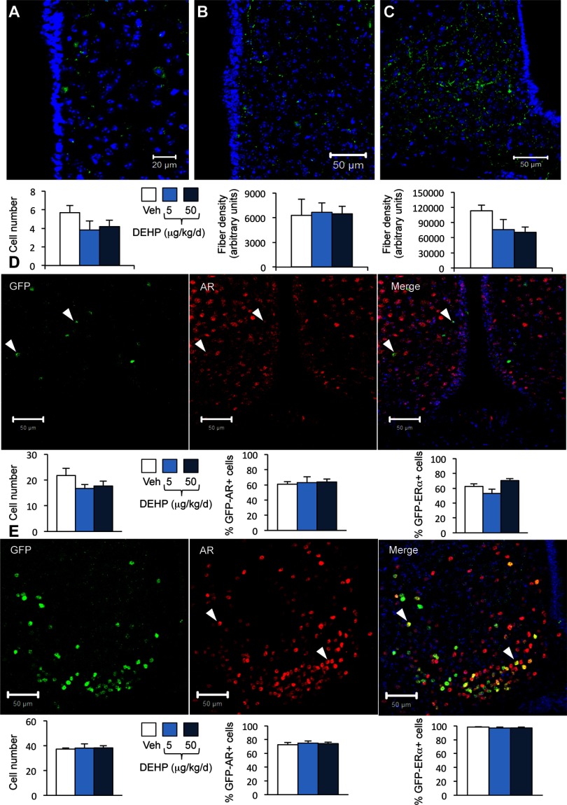 Figures 4A, 4B, and 4C comprise microscopic images and three bar graphs with standard errors of mean. Graph A plots cell number and Graphs B and C plot fiber density (arbitrary units) for the Veh and 5 and 50 micrograms per kilogram per day DEHP exposure groups. Figure 4D comprises three microscopic images for GFP, AR, and both merged, as well as three bar graphs with standard errors of mean plotting cell number, percentage of GFP-AR plus cells, and percentage of GFP-ER alpha plus cells for the Veh and 5 and 50 micrograms per kilogram per day DEHP exposure groups. Figure 4C comprises three microscopic images for GFP, AR, and both merged, as well as three bar graphs with standard errors of mean plotting cell number, percentage of GFP-AR plus cells, and percentage of GFP-ER alpha plus cells for the Veh and 5 and 50 micrograms per kilogram per day DEHP exposure groups.