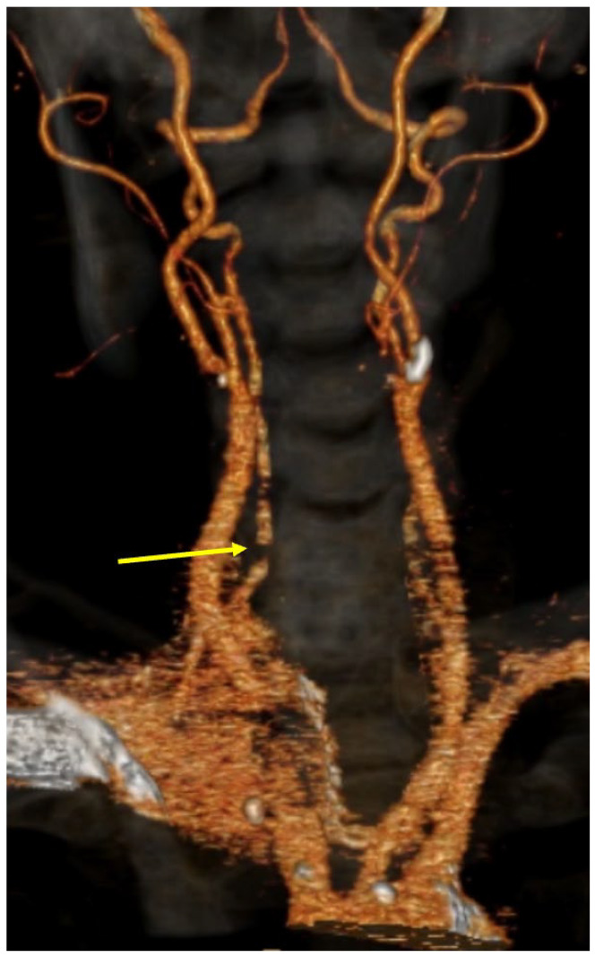 Figure 3.