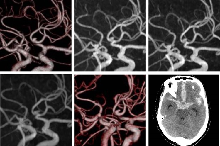 Figure 1: