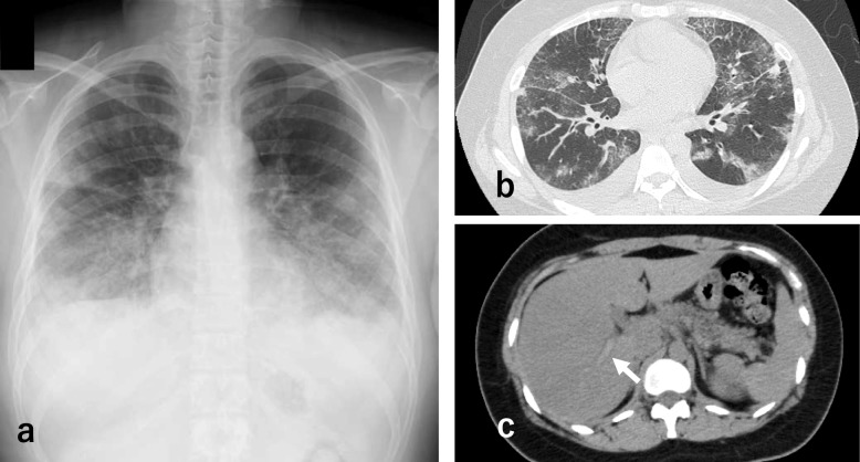 Fig. 1