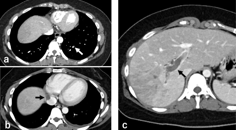 Fig. 3