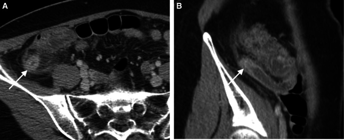 Fig. 5