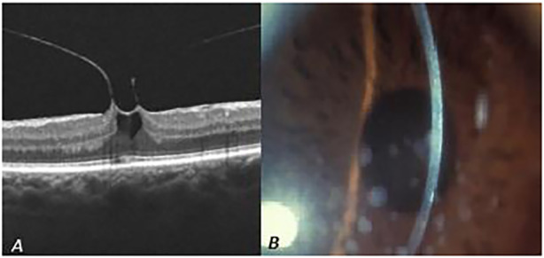 Fig. 6