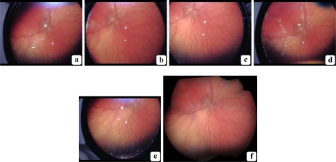 Fig. 10