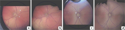 Fig. 12