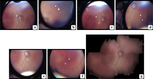 Fig. 11