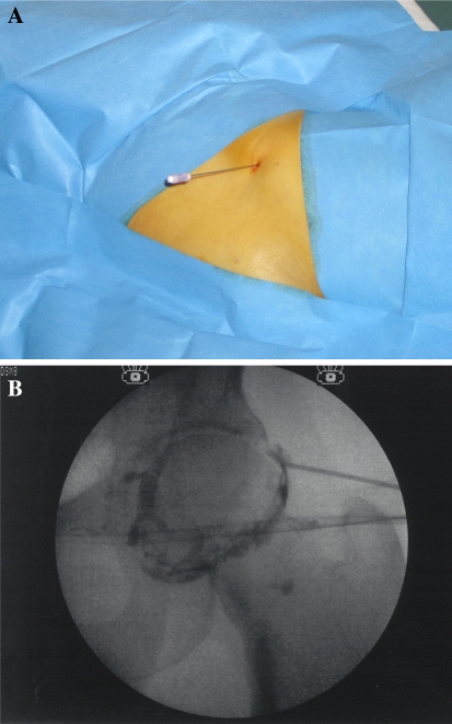 Fig. 1