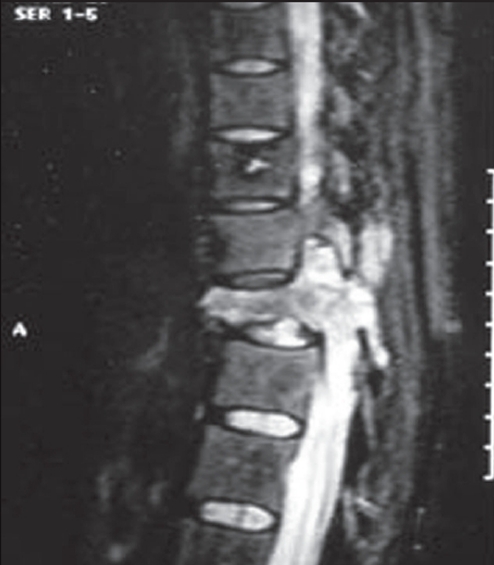 Figure 2A