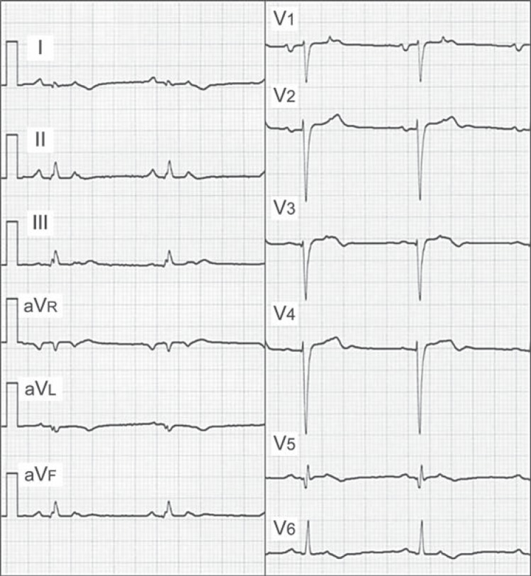 Fig. 2