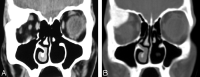 Fig 4.