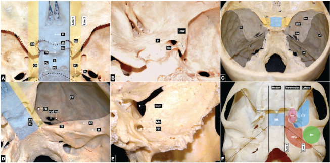 The Modular Concept in Skull Base Surgery: Anatomical Basis of the ...