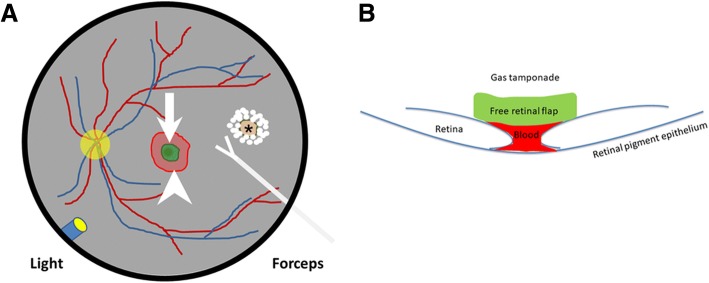 Fig. 1