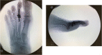 Fig. 10