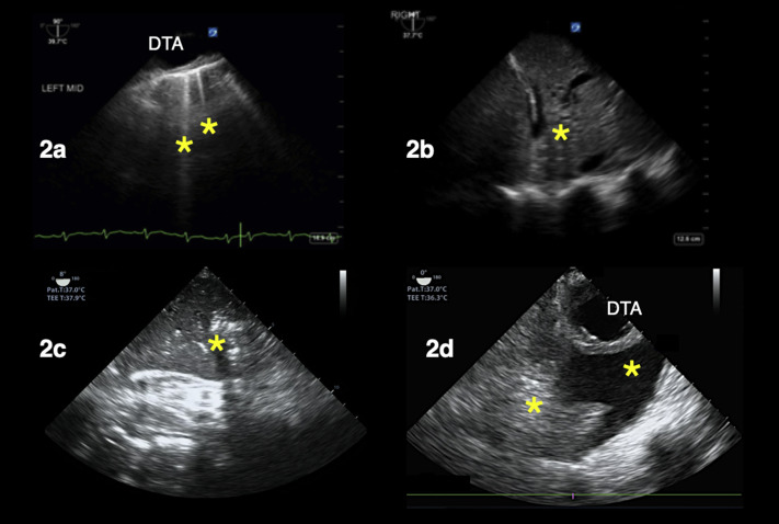 Figure 2