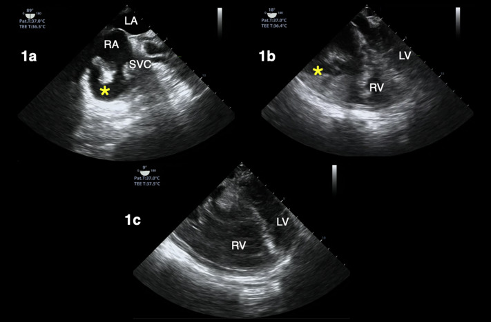 Figure 1