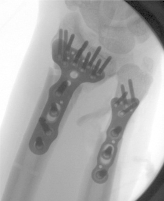 Fig. 27
