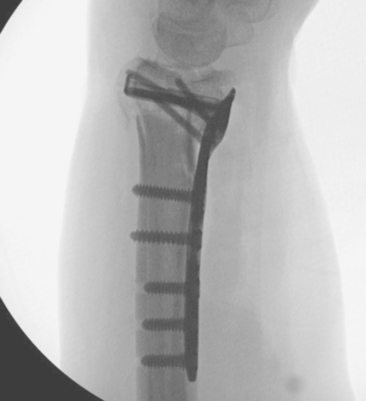 Fig. 5