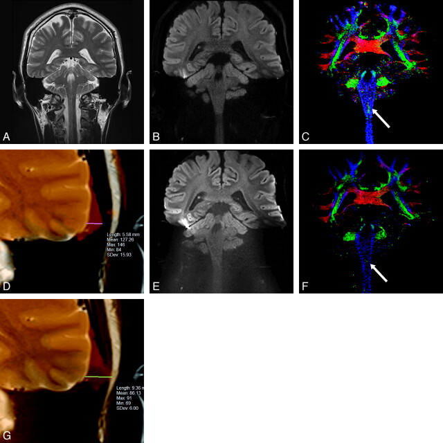 Fig 1.