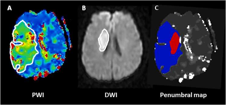 Fig. 1