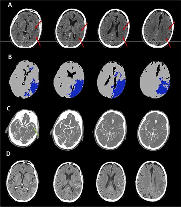 Fig. 6