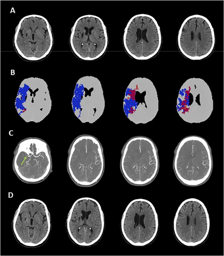 Fig. 7