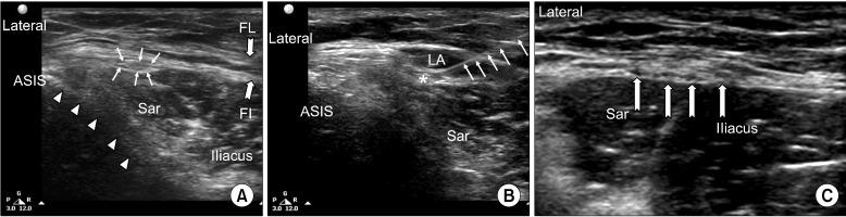 Fig. 11