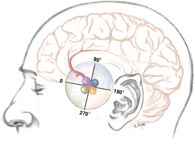 Fig. 3