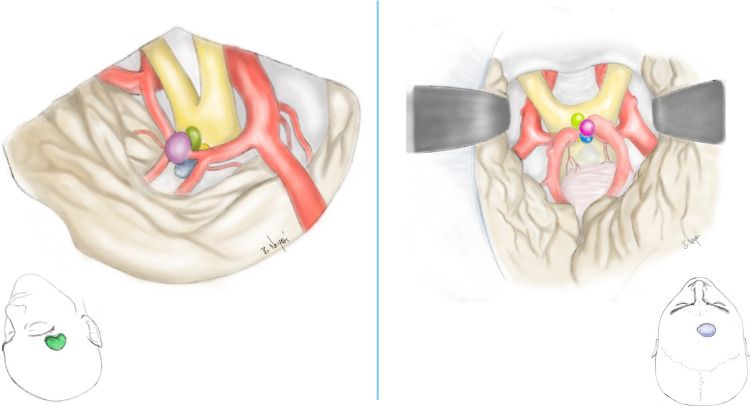 Fig. 1