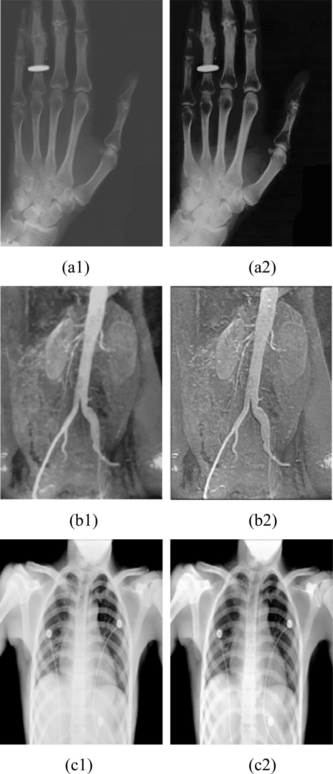 Fig. (3)