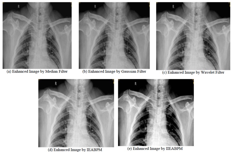 Fig. (6)