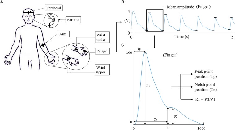 FIGURE 1