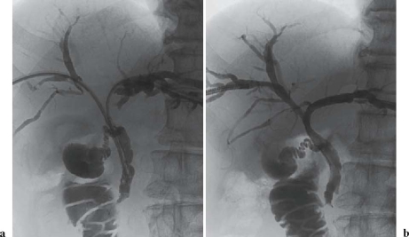 Fig. 1a,b