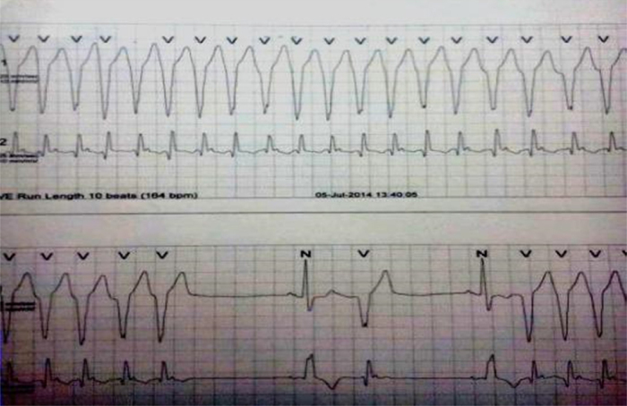 Fig. 2