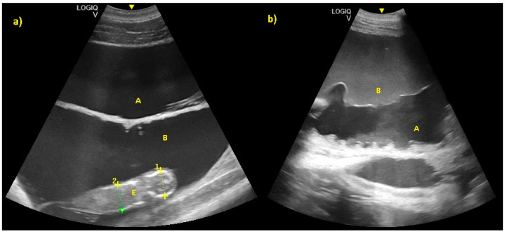 Figure 11