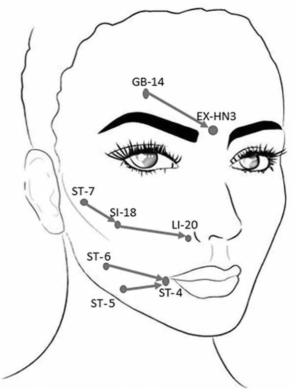 FIG. 2.
