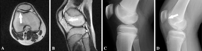 Fig. 3A–D