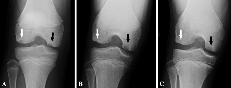 Fig. 1A–C