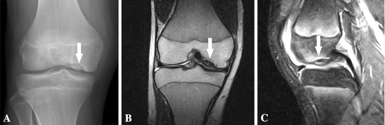 Fig. 2A–C