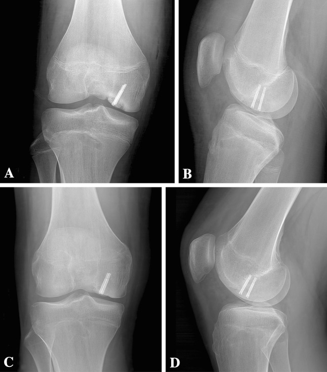 Fig. 7A–D