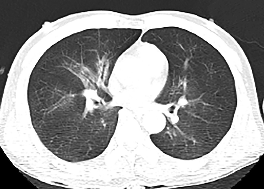 Fig. 1